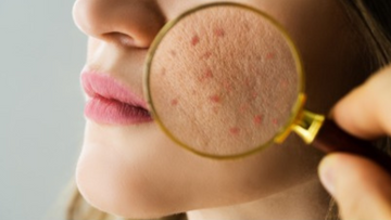 Skin Care Tips for a Glowing Complexion